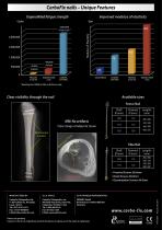 CarboFix Femur & Tibia Nails - 2