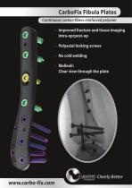 CarboFix Fibula Plates-1