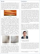 Experience with a New Absorbable Subcuticular Skin Stapler Designed For Short Incisions in Anterior Lumbar Interbody Fusion Surgery-2