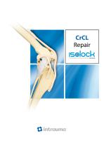 Isolock CrCL Procedure-1