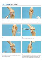 Isolock CrCL Procedure-4