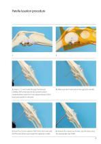ISOLOCKPatellaProcedure-3
