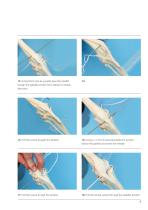ISOLOCKPatellaProcedure-5