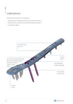 Kite - Distal fibula sterile kit-4