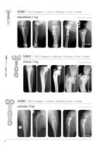 TPLO-4