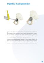 ACE Surgical Technique-7