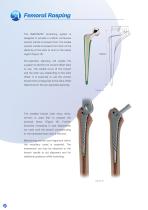 Avanteon Surgical Technique-10