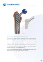 Avanteon Surgical Technique-11