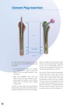 Avanteon Surgical Technique-12