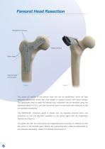 Avanteon Surgical Technique-4