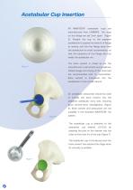 Avanteon Surgical Technique-6