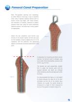 Avanteon Surgical Technique-9