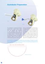 CSF Plus Surgical Technique-4