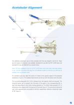CSF Plus Surgical Technique-5