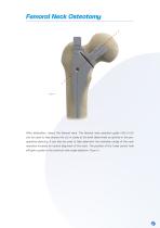 Furlong Evolution Surgical technique-7