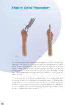 Furlong Evolution Surgical technique-8