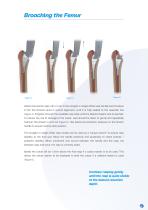 Furlong Evolution Surgical technique-9