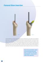 Furlong H-A.C Surgical technique-10