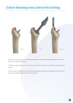 Furlong H-A.C Surgical technique-7