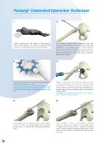 Hemiarthroplasty Surgical technique-6