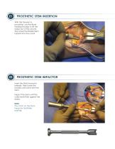 ALIGN ® Surgical Technique Guide-12