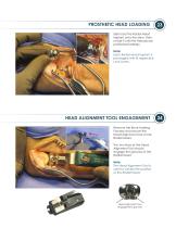 ALIGN ® Surgical Technique Guide-13