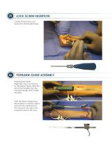 ALIGN ® Surgical Technique Guide-14