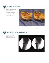 ALIGN ® Surgical Technique Guide-16