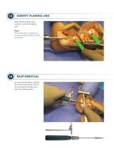 ALIGN ® Surgical Technique Guide-8
