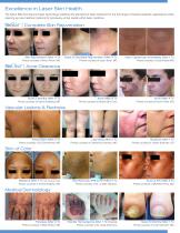 aesthetic medicine laser LightPod Neo-3