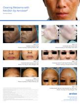 NeoSkin Melasma FAQ Sheet - 2