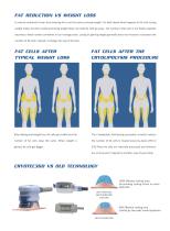 NUBWAY cryolipolysis CRYOTEC 360MINI-2