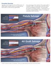 For Fistula or Graft Salvage Bypassing venous stenosis-3