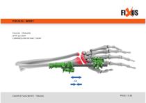 FIXUS - EXAMPLE PLACEMENTS - TRAUMA-10
