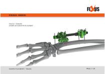 FIXUS - EXAMPLE PLACEMENTS - TRAUMA-11