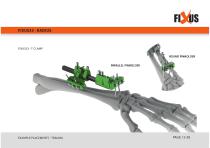 FIXUS - EXAMPLE PLACEMENTS - TRAUMA-12