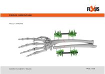 FIXUS - EXAMPLE PLACEMENTS - TRAUMA-13