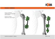 FIXUS - EXAMPLE PLACEMENTS - TRAUMA-15