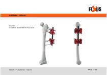 FIXUS - EXAMPLE PLACEMENTS - TRAUMA-23
