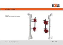 FIXUS - EXAMPLE PLACEMENTS - TRAUMA-24