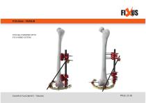 FIXUS - EXAMPLE PLACEMENTS - TRAUMA-25