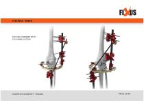 FIXUS - EXAMPLE PLACEMENTS - TRAUMA-26