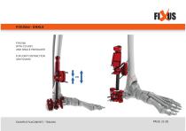 FIXUS - EXAMPLE PLACEMENTS - TRAUMA-32