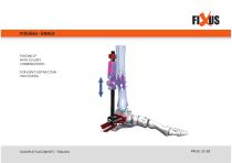 FIXUS - EXAMPLE PLACEMENTS - TRAUMA-35