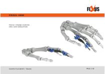 FIXUS - EXAMPLE PLACEMENTS - TRAUMA-3