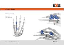 FIXUS - EXAMPLE PLACEMENTS - TRAUMA-4