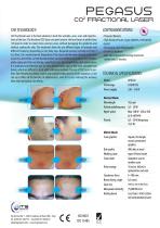 CO2 Fractional Laser-2