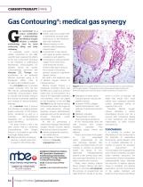 Oxyneedling and Gas Contouring - 4