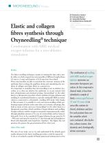 Oxyneedling and synthesis of elastic and collagen fibers - 2