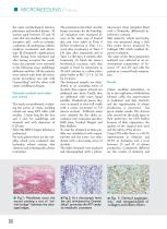 Oxyneedling and synthesis of elastic and collagen fibers - 3